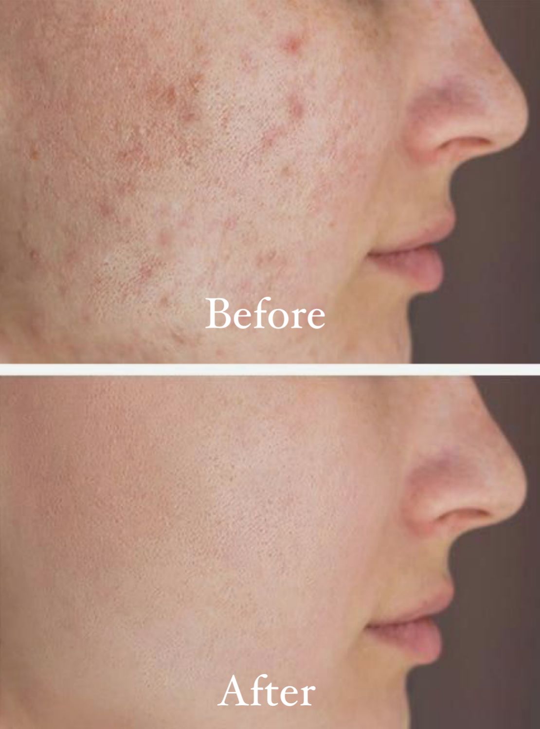 SEAWEED GEL FACEWASH - 100 ML