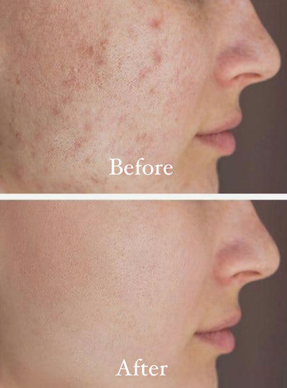 SEAWEED GEL FACEWASH - 100 ML